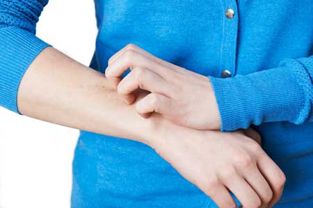 Itching Skin Get relief for your dry, cracked and itching skin with PsoMaxx Salve for Eczema and Psoriasis