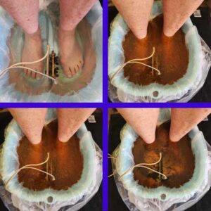 Ionizing Detox Foot Spa to purge inflammation